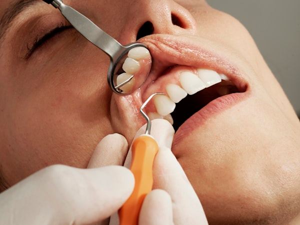 Modelo de un implante dental